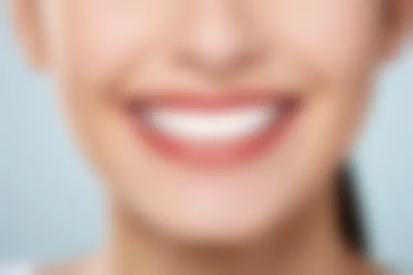 福建福清茉莉口腔门诊部补牙收费现仅需600元起，原价800元起，抓住这个超值优惠机会！