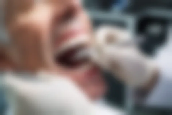 厦门齿度第七口腔门诊部牙齿矫正限时优惠，原价8000元起，现在仅需6800元起，助您轻松展现自信笑容，机会不容错过！