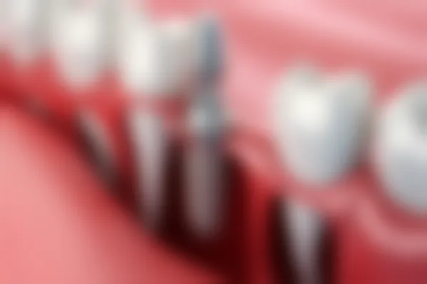 深圳博亚口腔门诊部口腔颌面外科原价6000元起，现优惠价仅需4800元起，欢迎前来享受超值服务！