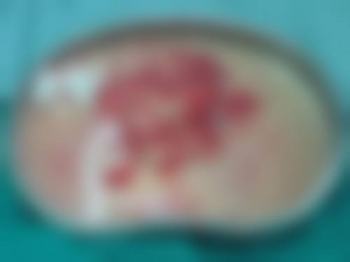 国内推荐10家奥美定取出技术领跑医院