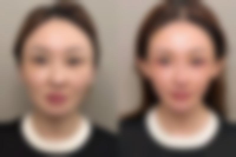 李发成医生口碑评价