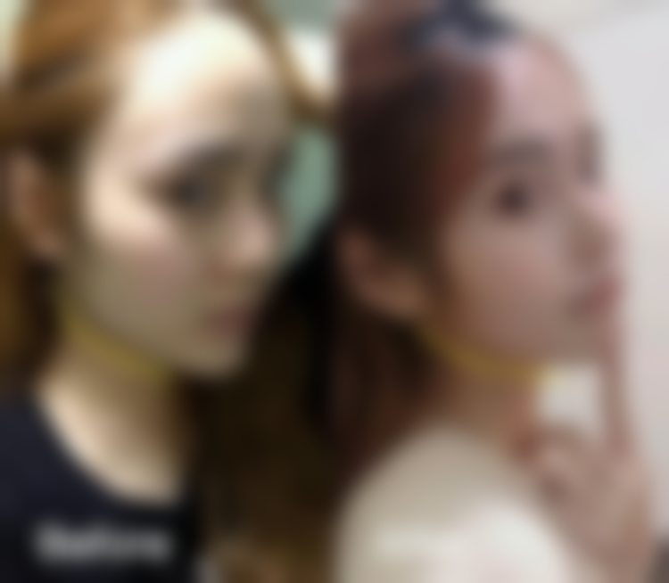 杭州连天美医疗美容医院预约挂号方式