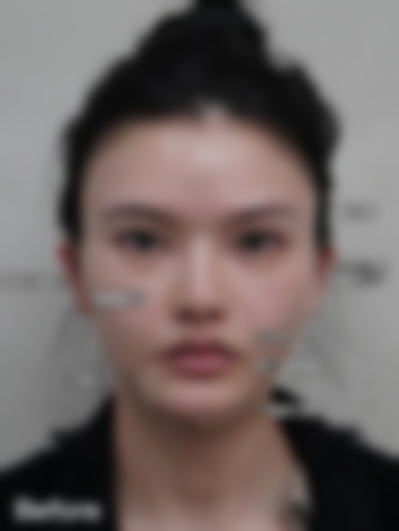 西安艺星医疗美容医院收费价格表