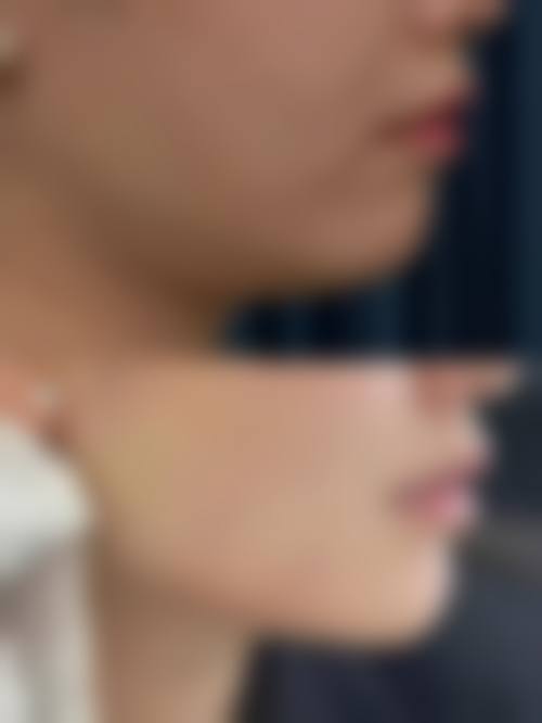 井明医生技术优势