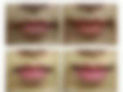 杜云鹏医生技术优势