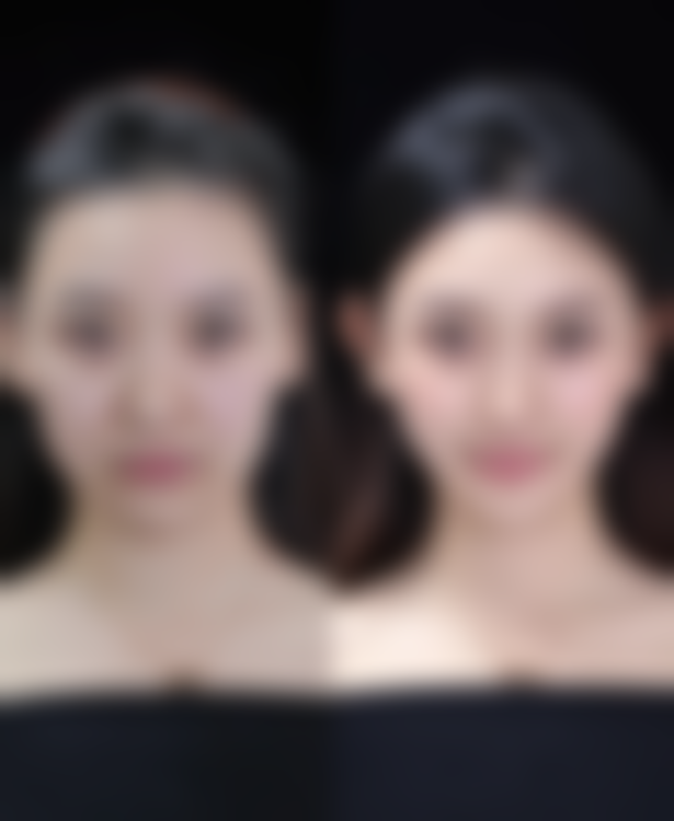 吕志敏医生技术优势