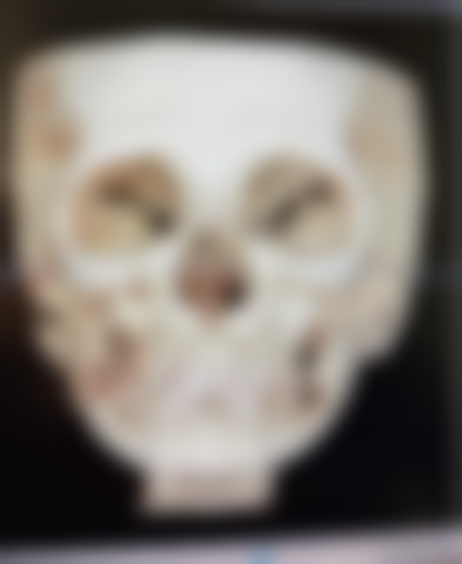 吕志敏医生预约挂号