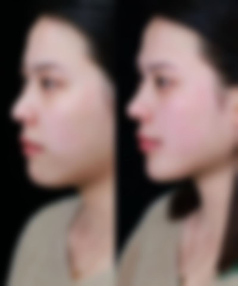 重庆綦江妃尚抗衰整形美容医院收费价格表