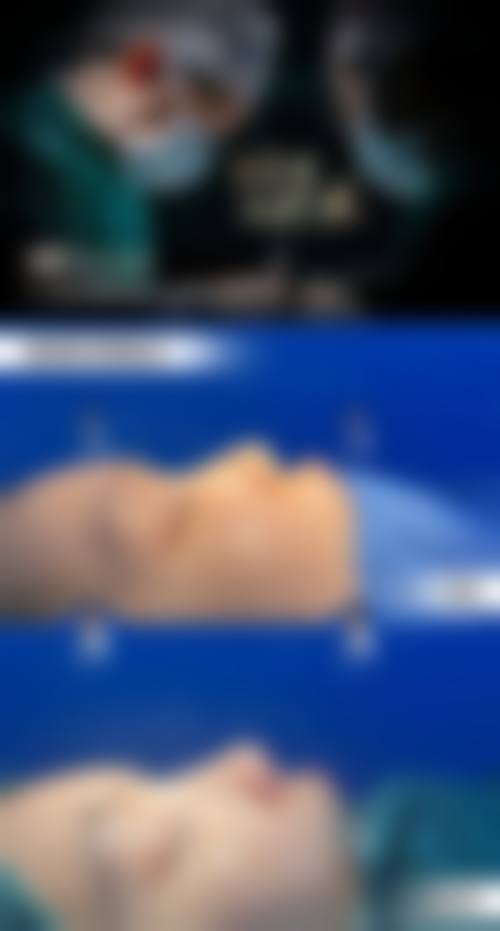 陈先卓医生技术优势