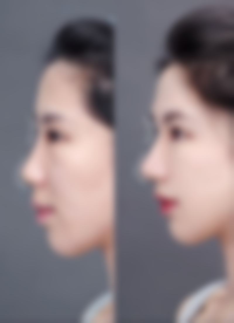 丁小燕医生项目收费价格