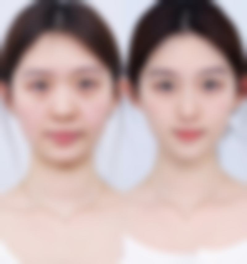 韩国BFline整形外科医生团队介绍