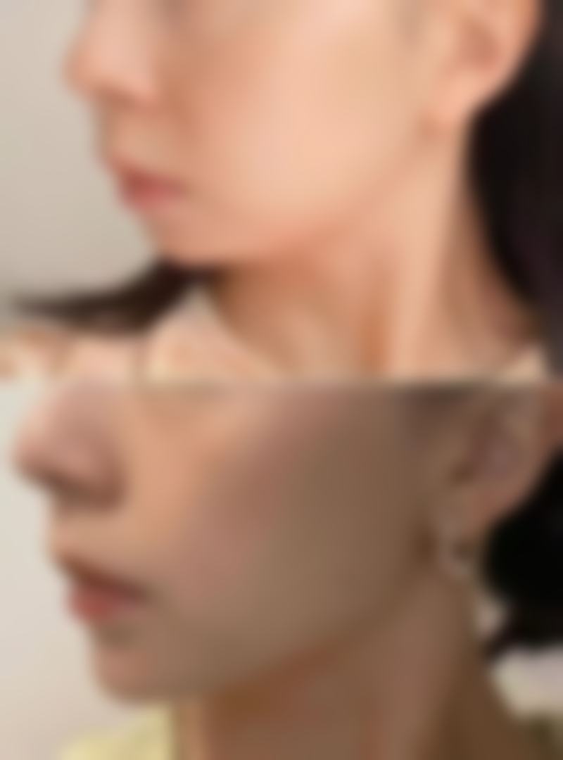 通辽沐鑫医疗美容诊所收费价格表