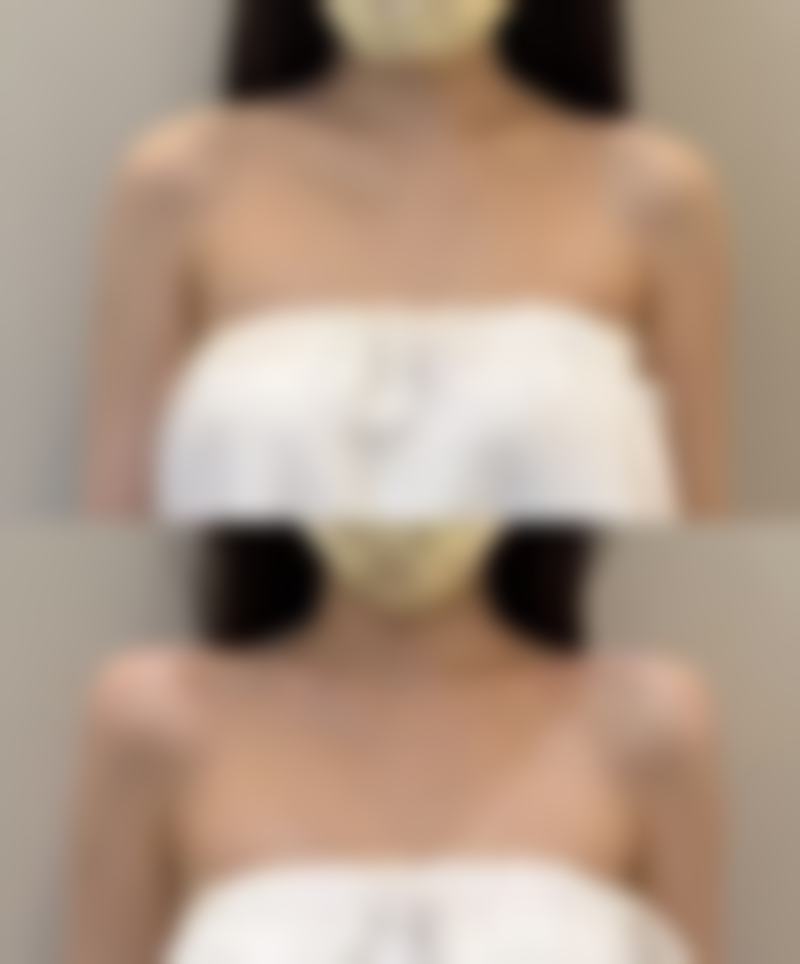 喀什珀蔻整形医院收费价格表