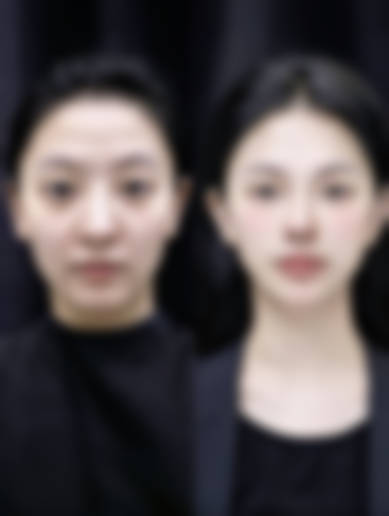 王崇树医生项目收费价格