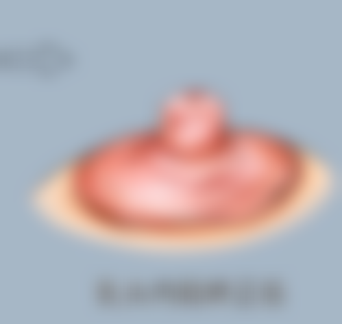 李克彪医生项目收费价格