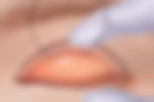 史虎峰医生预约挂号