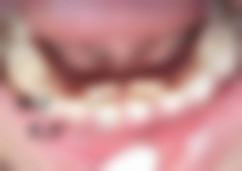 李克奋医生技术优势