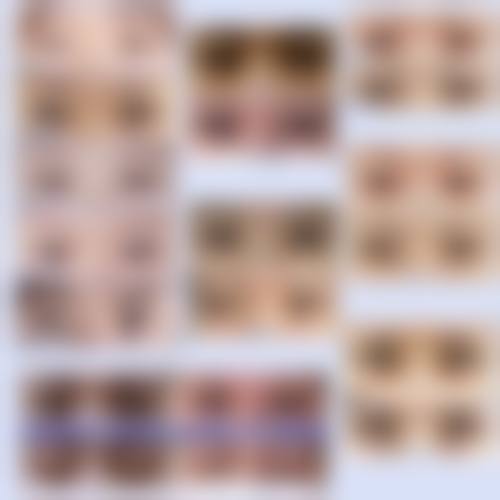 韩国eyemagic李喜文整形医院预约挂号方式