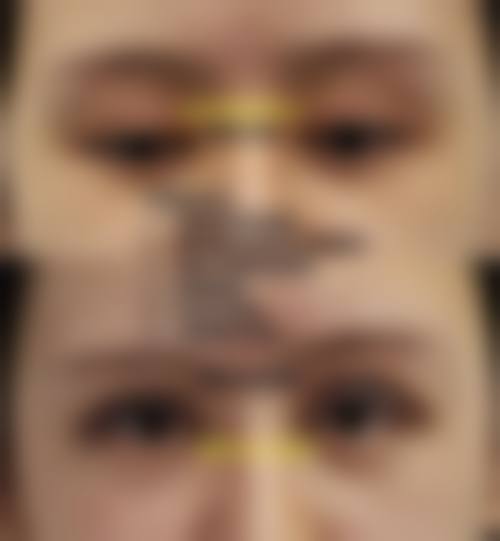 虎珂医生项目收费价格