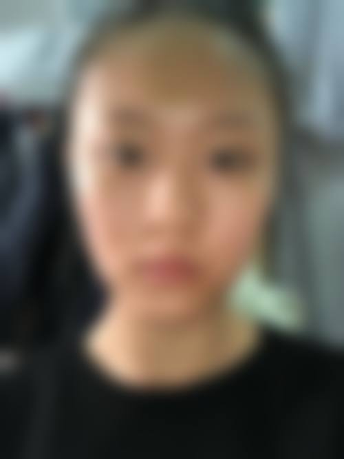 亚明宏医生项目收费价格