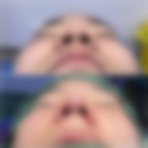 方明松医生项目收费价格