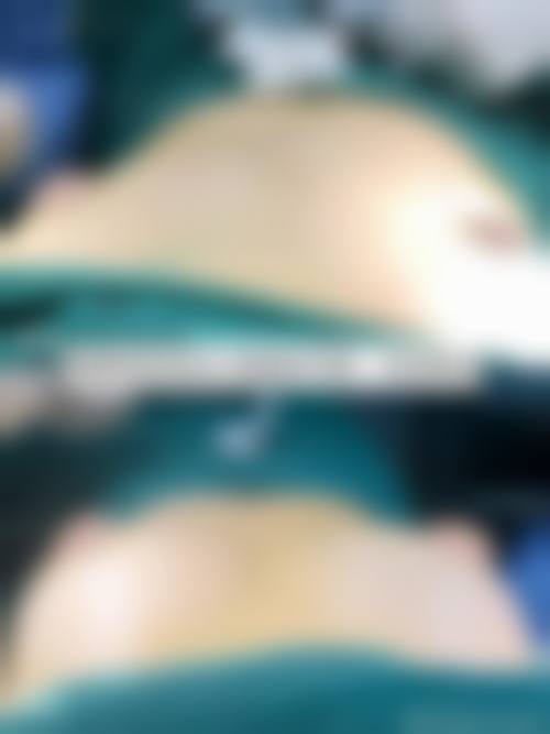 方明松医生技术优势