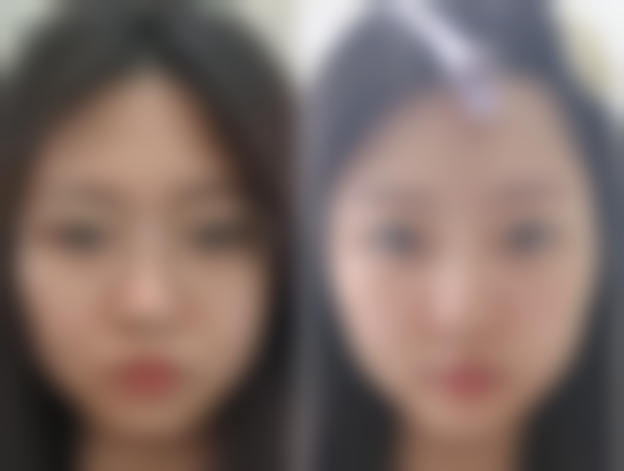 史虎峰医生项目收费价格