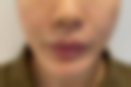 苏州爱思特整形医院预约挂号方式