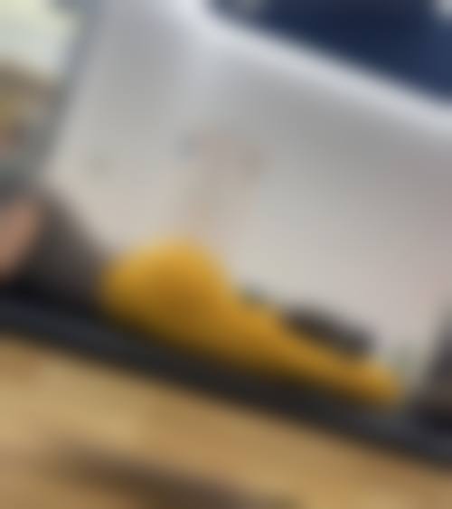 余刚医生项目收费价格