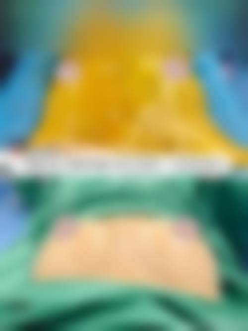 余刚医生技术优势