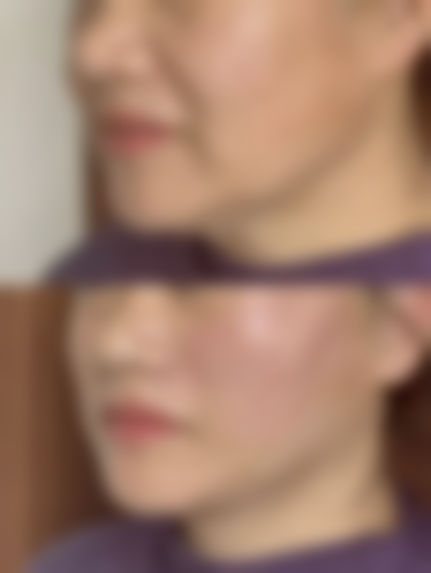 兰州陈晨中医针灸美容机构收费价格表