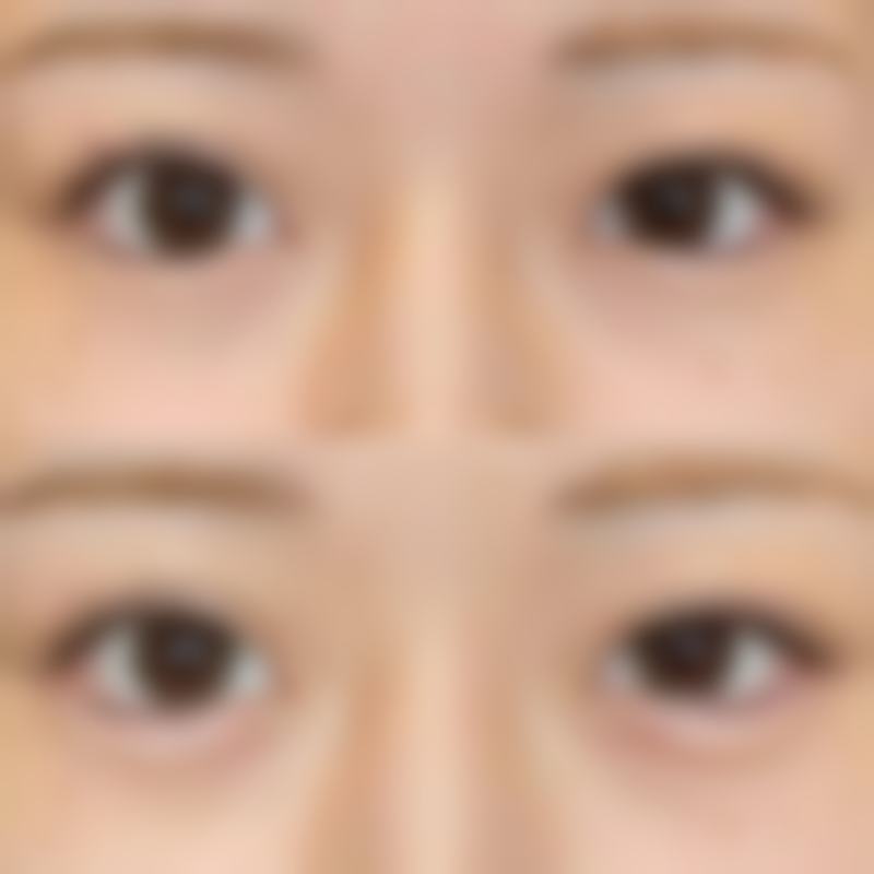 郑州轻颜美医疗美容门诊部收费价格表