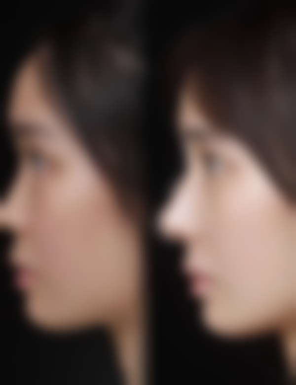 长沙伊美医疗美容医院预约挂号方式