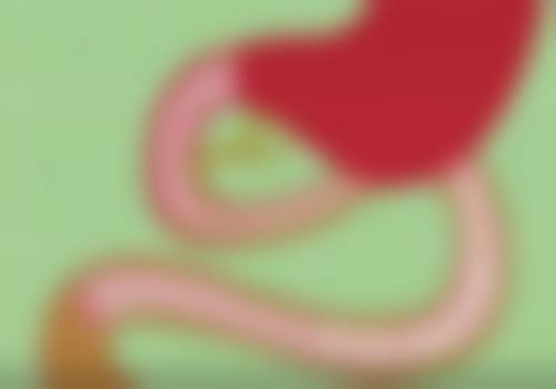 刘凤斌医生技术优势