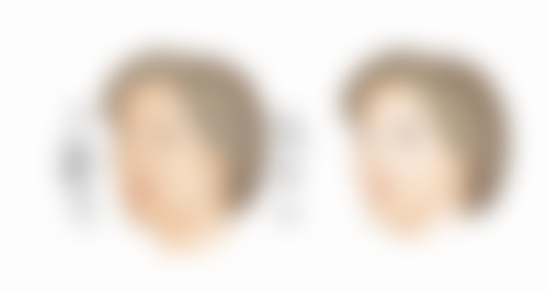 张瑞雨医生口碑评价及反馈内容