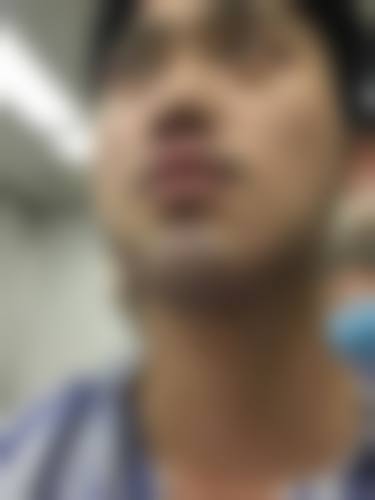 祁强医生预约挂号