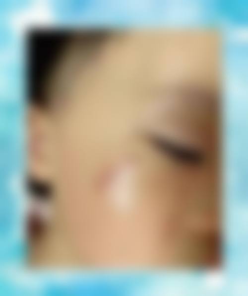 张正中医生项目收费价格