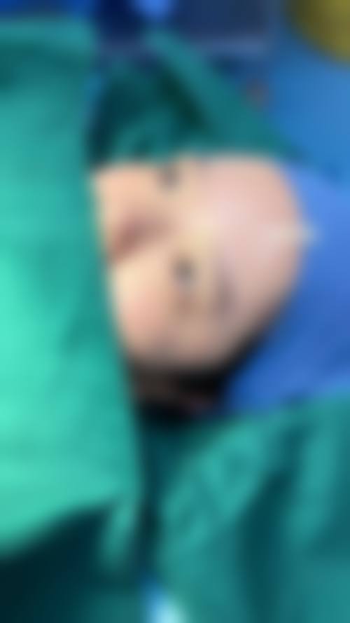 方明松医生项目收费价格