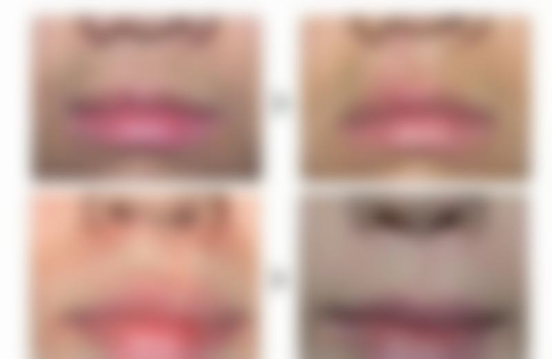 张正中医生预约挂号