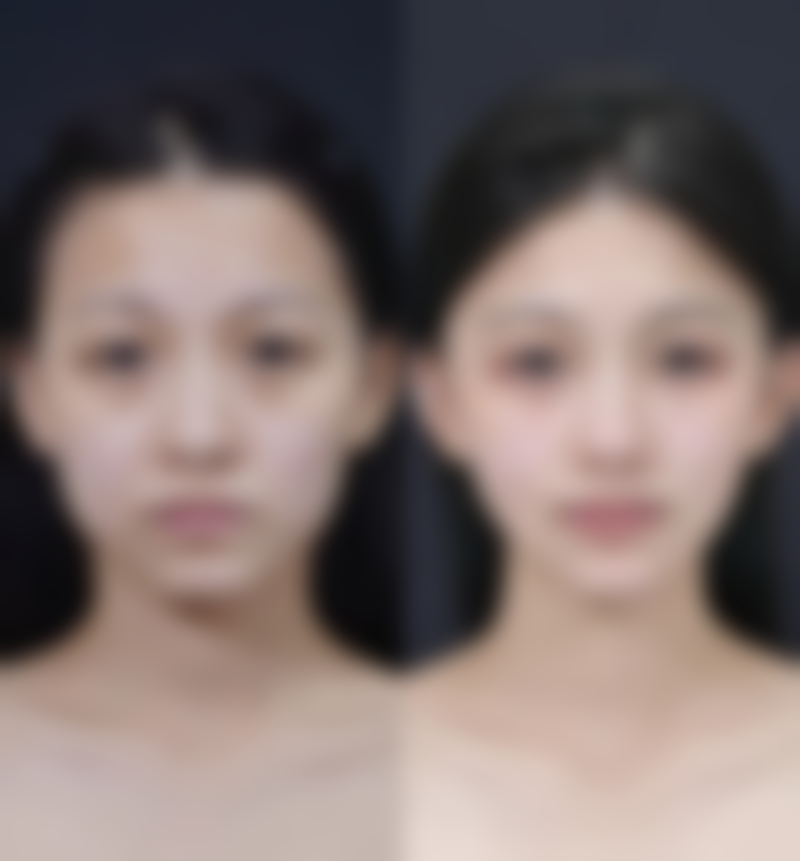 刘凤斌医生预约挂号