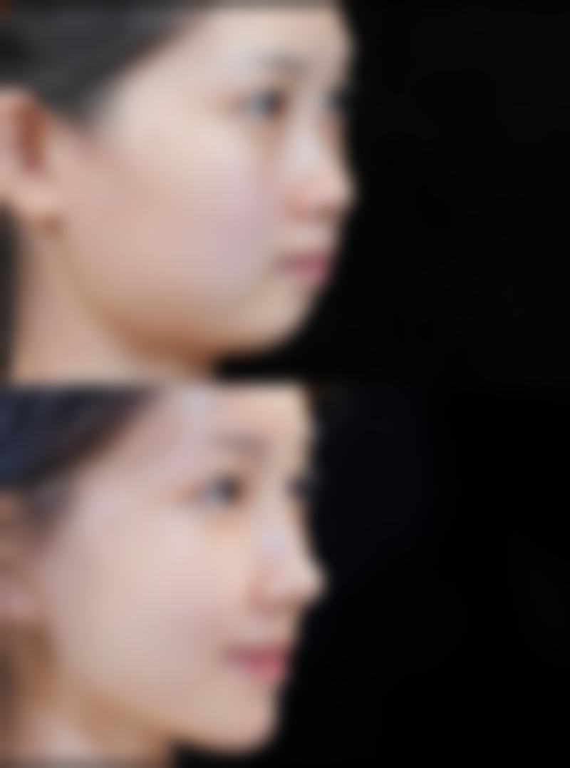 陈朗医生技术优势