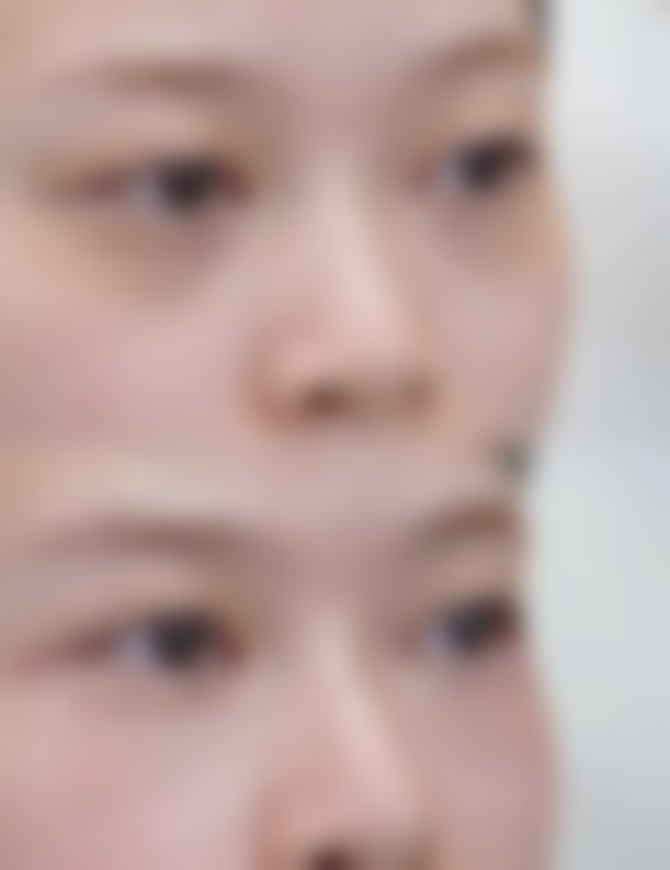 赵成仁医生技术优势