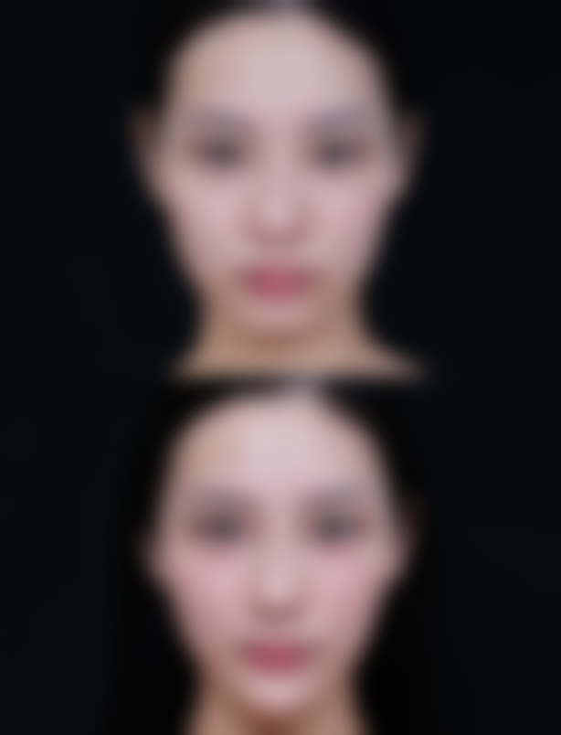 深圳驻颜静合医疗美容诊所预约挂号方式