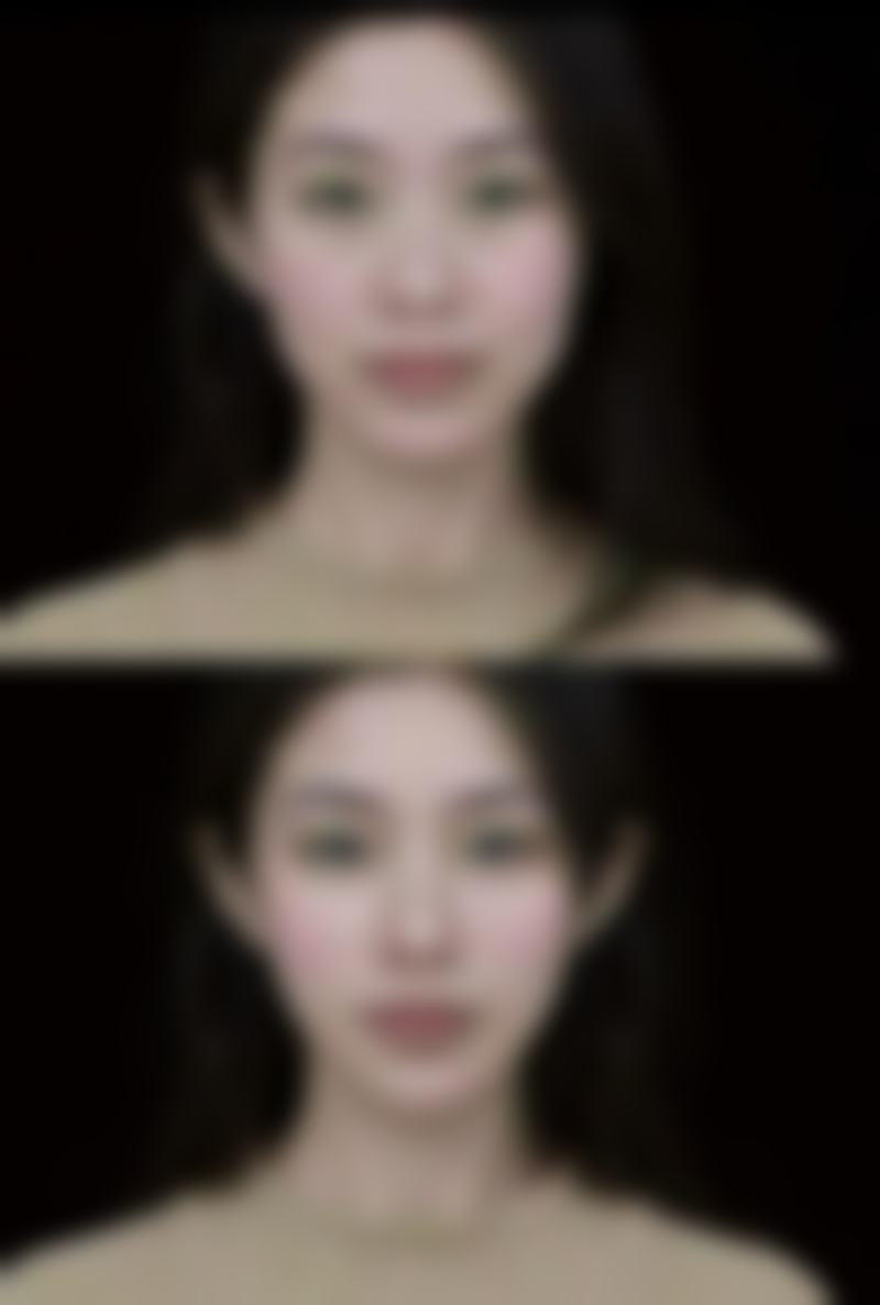 郑晓明医生项目收费价格