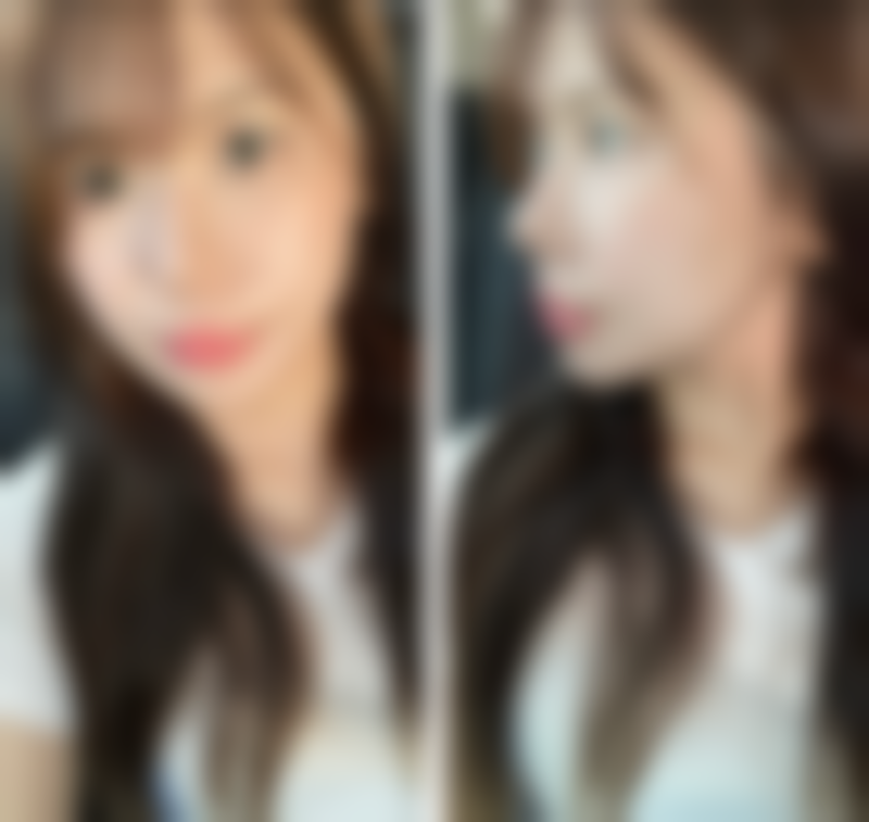 成都美极整形医疗美容门诊部收费价格表