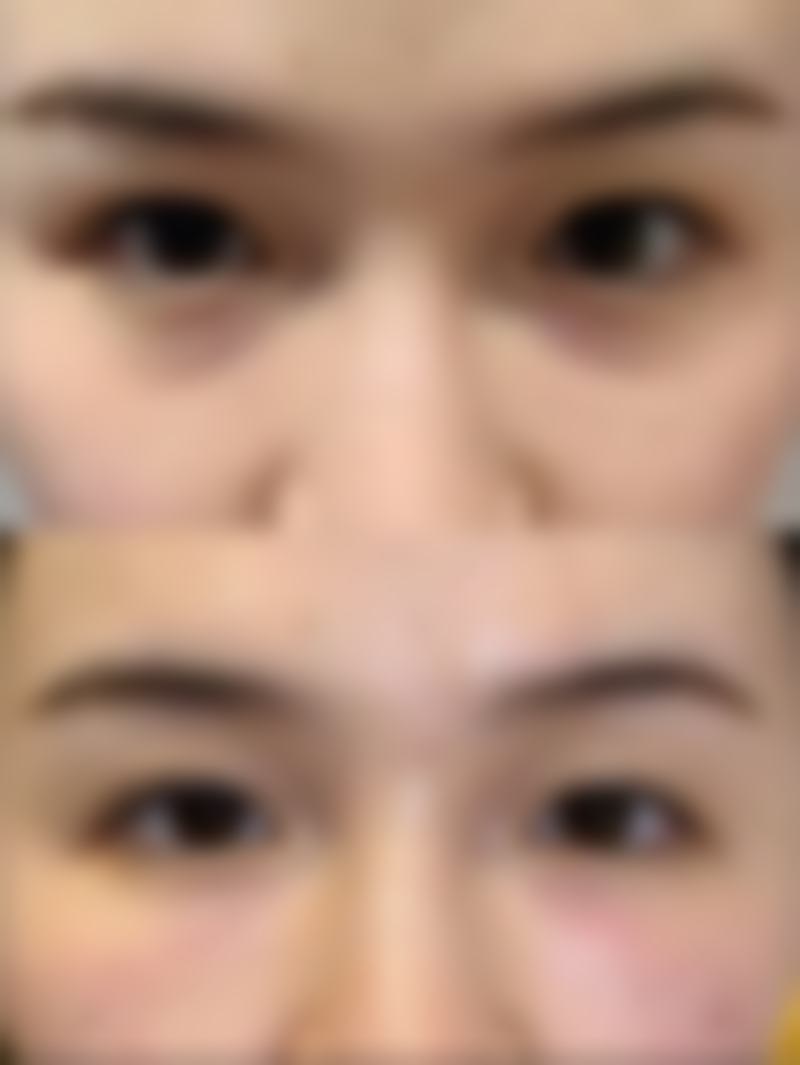 赵成仁医生项目收费价格