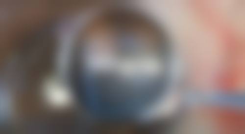 黄秀丽医生技术优势