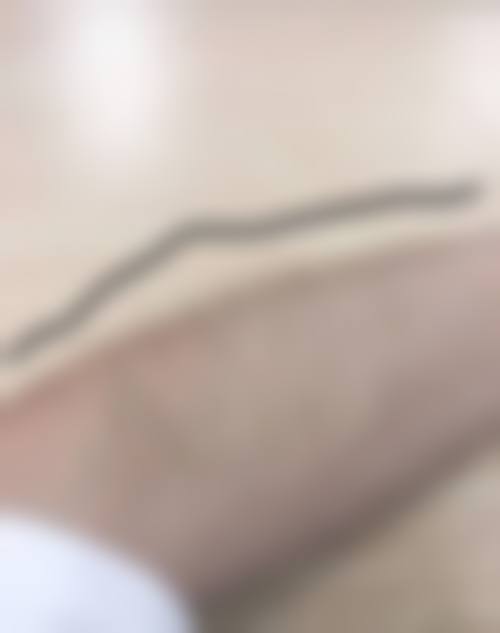 卢植生医生技术优势