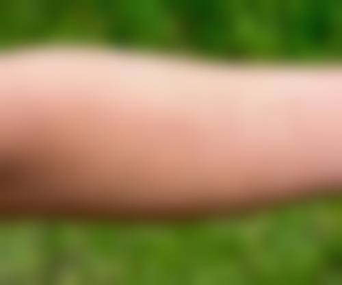 卢植生医生口碑评价及反馈内容