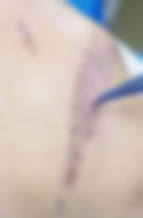 祁强医生技术优势